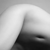 A black and white photo show of a woman's labiaplasty recovery