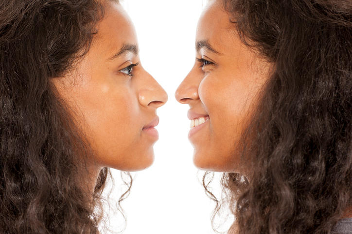 comparison of young black woman before and after nose surgery - ethnic rhinoplasty. 