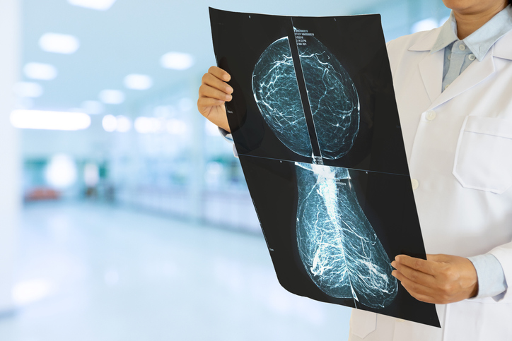 breast augmentation mammogram results